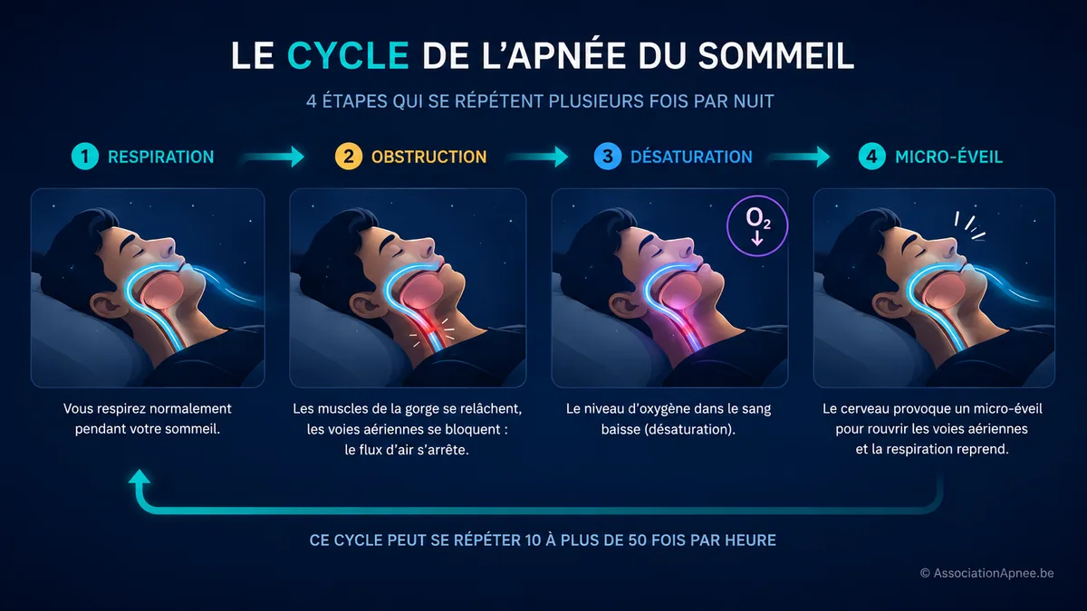 Infographie expliquant le cycle de l'apnée du sommeil en 4 étapes : respiration normale, obstruction des voies aériennes, désaturation en oxygène, micro-éveil cérébral. Ce cycle peut se répéter 10 à plus de 50 fois par heure.